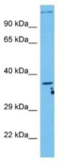 C5L2/GPR77 Rabbit anti-Human, Polyclonal, Novus Biologicals 100 &mu;g;